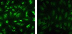 Invitrogen™ Phospho-JNK1/JNK2 (Thr183, Tyr185) Recombinant Rabbit Monoclonal Antibody (D12H7L17)