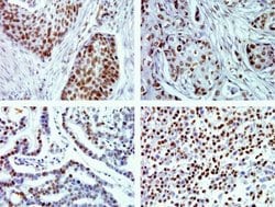 Invitrogen Phospho-JNK1/JNK2 (Thr183, Tyr185) Recombinant Rabbit Monoclonal