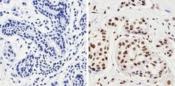 Invitrogen Phospho-JNK1/JNK2 (Thr183, Tyr185) Recombinant Rabbit Monoclonal