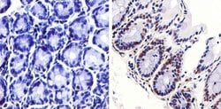 Invitrogen Phospho-JNK1/JNK2 (Thr183, Tyr185) Recombinant Rabbit Monoclonal