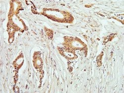 Invitrogen Phospho-PKC theta (Thr538) Recombinant Rabbit Monoclonal Antibody