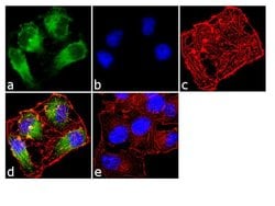 Invitrogen TAK1 Recombinant Rabbit Monoclonal Antibody (28H25L68) 100 &mu;g;