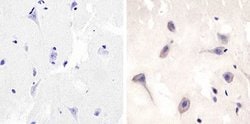 Invitrogen TRAF3 Recombinant Rabbit Monoclonal Antibody (12H13L59) 100