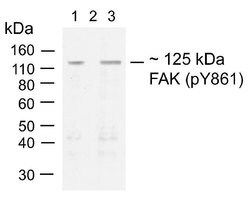 Invitrogen Phospho-FAK (Tyr861) Recombinant Rabbit Monoclonal Antibody
