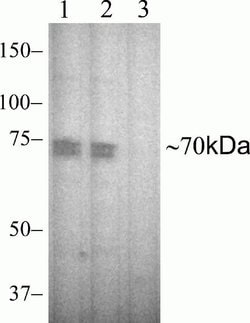 Invitrogen Phospho-Zap-70 (Tyr315, Tyr319) Recombinant Rabbit Monoclonal Antibody (4H16L19) 100 &mu;g | Buy Online | Invitrogen&trade; | Fisher Scientific