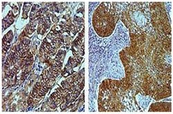 Invitrogen Claudin 18 Recombinant Rabbit Monoclonal Antibody (34H14L15)