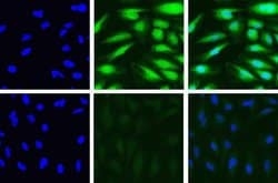 Invitrogen PSME3 Recombinant Rabbit Monoclonal Antibody (20H9L19) 100 &mu;g;