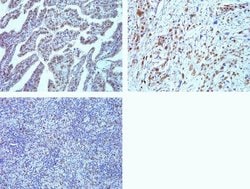 Invitrogen PSME3 Recombinant Rabbit Monoclonal Antibody (20H9L19) 100 &mu;g;
