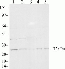 Invitrogen PSME3 Recombinant Rabbit Monoclonal Antibody (20H9L19) 100 &mu;g;