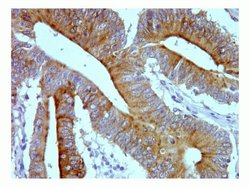Invitrogen SUMO-3 Recombinant Rabbit Monoclonal Antibody (1H9L17) 100 &mu;g;