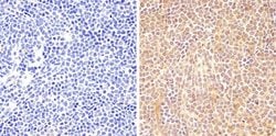 Phospho-STAT6 (Tyr641) Recombinant Rabbit Monoclonal Antibody (46H1L12):Antibodies,