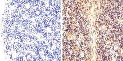Phospho-STAT6 (Tyr641) Recombinant Rabbit Monoclonal Antibody (46H1L12):Antibodies,