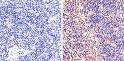 Phospho-STAT6 (Tyr641) Recombinant Rabbit Monoclonal Antibody (46H1L12):Antibodies,