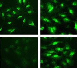 Phospho-STAT6 (Tyr641) Recombinant Rabbit Monoclonal Antibody (46H1L12):Antibodies,