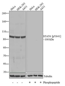 Phospho-STAT6 (Tyr641) Recombinant Rabbit Monoclonal Antibody (46H1L12):Antibodies,
