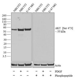 Phospho-AKT1 (Ser473) Recombinant Rabbit Monoclonal Antibody (99H9L9):Antibodies,