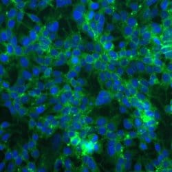 Invitrogen PKR Recombinant Rabbit Monoclonal Antibody (23H52L96) 100 &mu;g | Buy Online | Invitrogen&trade; | Fisher Scientific