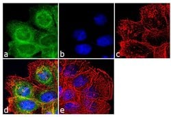 Invitrogen MDA5 Recombinant Rabbit Monoclonal Antibody (33H12L34) 100 &mu;g;