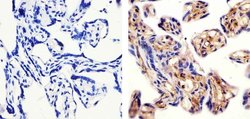 Invitrogen MDA5 Recombinant Rabbit Monoclonal Antibody (33H12L34) 100 &mu;g;