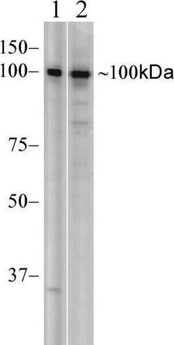 Invitrogen MDA5 Recombinant Rabbit Monoclonal Antibody (33H12L34) 100 &mu;g;