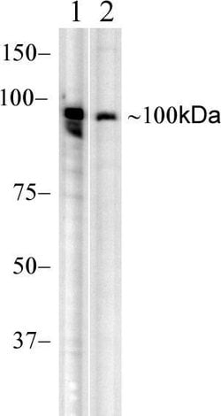 RIG-I Recombinant Rabbit Monoclonal Antibody (35H2L48):Antibodies, Recombinant