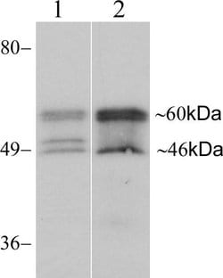 Invitrogen Connexin 46 Recombinant Rabbit Monoclonal Antibody (11H16L33)