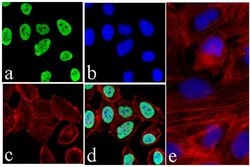 Invitrogen Survivin Recombinant Rabbit Monoclonal Antibody (9H18L32) 100