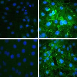 Invitrogen Phospho-AKT1 (Ser473) Recombinant Rabbit Monoclonal Antibody