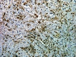 Invitrogen Phospho-AKT1 (Ser473) Recombinant Rabbit Monoclonal Antibody