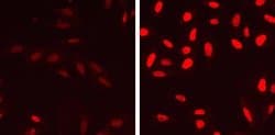 Invitrogen Phospho-p53 (Ser15) Recombinant Rabbit Monoclonal Antibody (14H61L24)