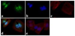 Invitrogen Phospho-p53 (Ser15) Recombinant Rabbit Monoclonal Antibody (14H61L24)