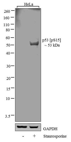Invitrogen Phospho-p53 (Ser15) Recombinant Rabbit Monoclonal Antibody (14H61L24)