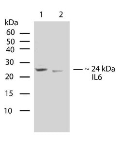 Invitrogen IL-6 Recombinant Rabbit Monoclonal Antibody (C7H24L3) 100 &mu;g;