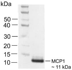 MCP-1 Recombinant Rabbit Monoclonal Antibody (29H86L56):Antibodies, Recombinant