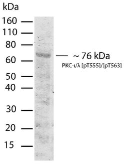 Invitrogen Phospho-PKC lambda/iota (Thr555, Thr563) Recombinant Rabbit