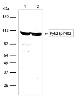 Invitrogen Phospho-PYK2 (Tyr402) Recombinant Rabbit Monoclonal Antibody (17H4L19) 100 &mu;g | Buy Online | Invitrogen&trade; | Fisher Scientific