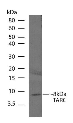 Invitrogen TARC Recombinant Rabbit Monoclonal Antibody (B22H33L5) 100 &mu;g;