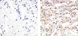 Invitrogen CXCL5 Recombinant Rabbit Monoclonal Antibody (9H45L5) 100 &mu;g;