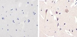 Invitrogen NMDAR1 Recombinant Rabbit Monoclonal Antibody (1H13L3) 100 &mu;g;