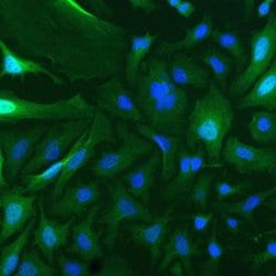 Invitrogen Securin Recombinant Rabbit Monoclonal Antibody (19H16L48) 100