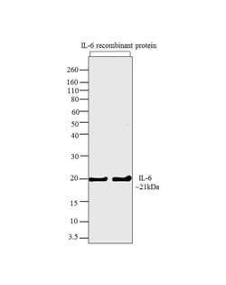 Invitrogen IL-6 Recombinant Rabbit Monoclonal Antibody (4H16L21) 100 &mu;g;