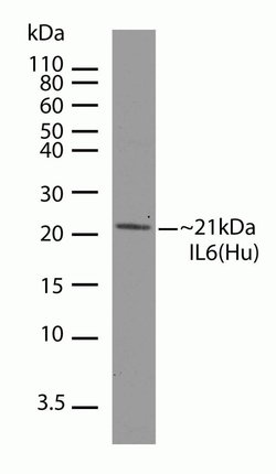 Invitrogen IL-6 Recombinant Rabbit Monoclonal Antibody (4H16L21) 100 &mu;g;
