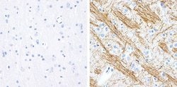 Invitrogen Phospho-Tau (Ser199) Recombinant Rabbit Monoclonal Antibody