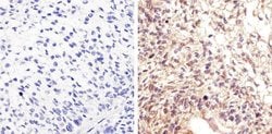 Invitrogen Phospho-STAT5 alpha (Tyr694) Recombinant Rabbit Monoclonal Antibody