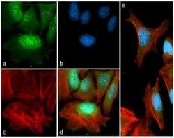 Invitrogen Phospho-p70 S6 Kinase (Thr389) Recombinant Rabbit Monoclonal