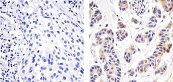 Invitrogen NFkB p65 Recombinant Rabbit Monoclonal Antibody (4-2H22L23)