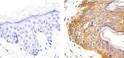 Invitrogen IL-2 Recombinant Rabbit Monoclonal Antibody (2H20L7) 100 &mu;g | Buy Online | Invitrogen&trade; | Fisher Scientific