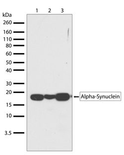Invitrogen alpha Synuclein Recombinant Rabbit Monoclonal Antibody (14H2L1) 100 &mu;g | Buy Online | Invitrogen&trade; | Fisher Scientific