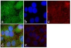 Invitrogen FAK Recombinant Rabbit Monoclonal Antibody (5H18L19) 100 &mu;g;