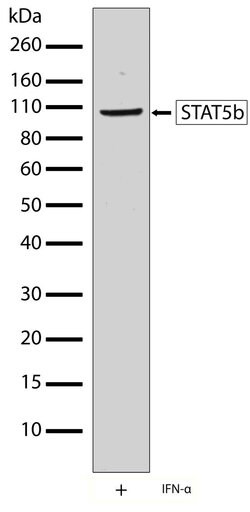 Invitrogen STAT5 beta Recombinant Rabbit Monoclonal Antibody (13H20L4)